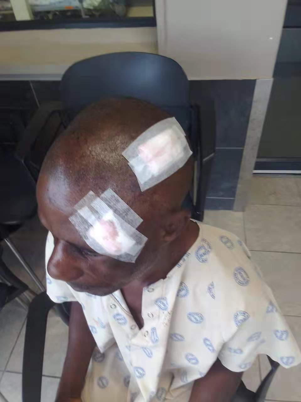 ANOTHER ZIMBABWEAN BADLY HURT BY LOCALS IN SOUTH&nbsp;AFRICA